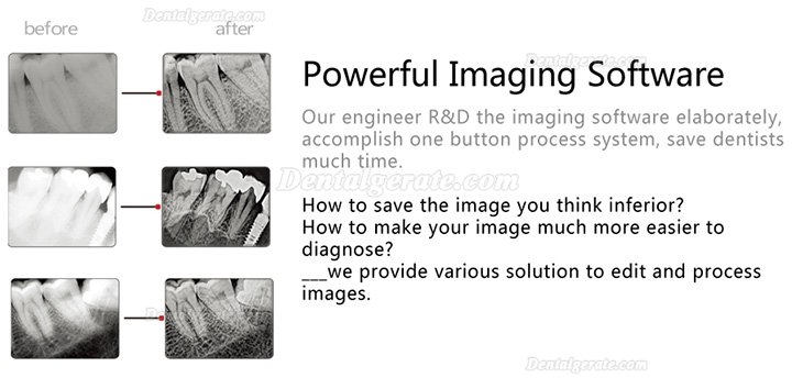 Handy HDR-600A Digitaler Intraorale R&ouml;ntgensensor Zahn&auml;rztlich Intraorale Flachkollektoren